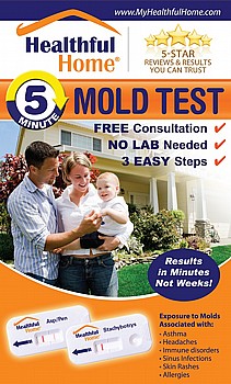 ���� ������ ������ ���� mold kit